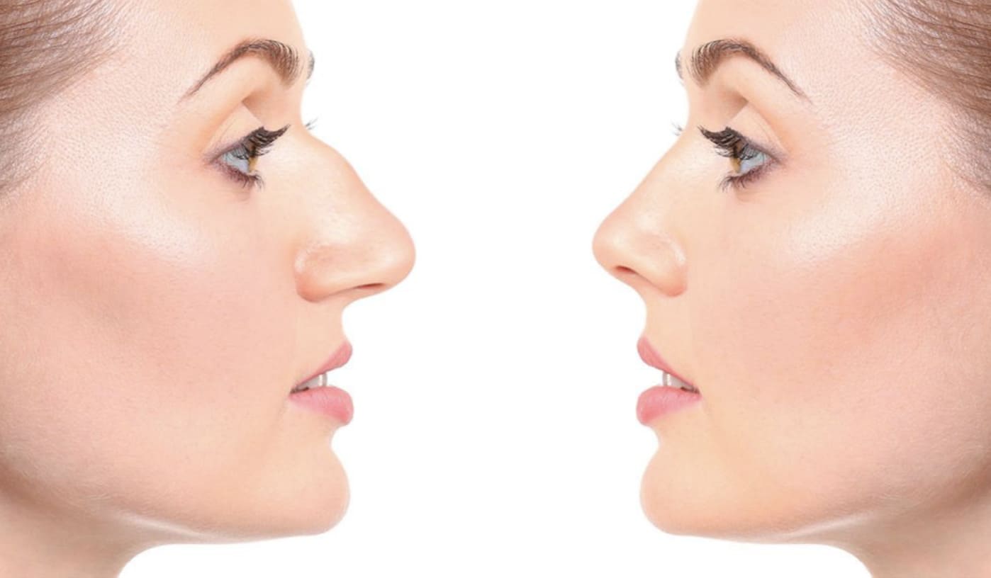 http://hoangminhjsc.com/editor-foto-corpo-e-viso-lite4.html/