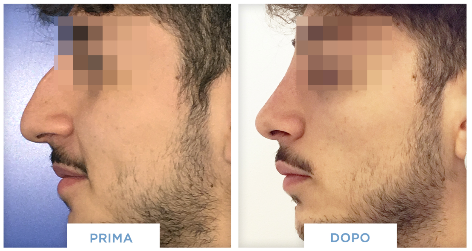 http://hoangminhjsc.com/editor-foto-corpo-e-viso-lite4.html/