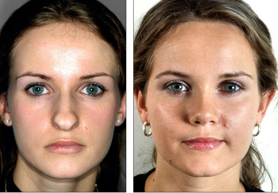 http://hoangminhjsc.com/editor-foto-corpo-e-viso-lite4.html/